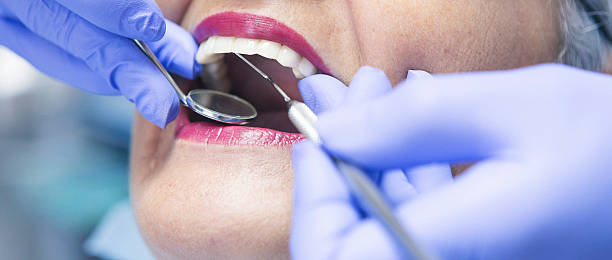 Best Emergency Treatment for Dental Infections or Abscesses in Fairport, NY